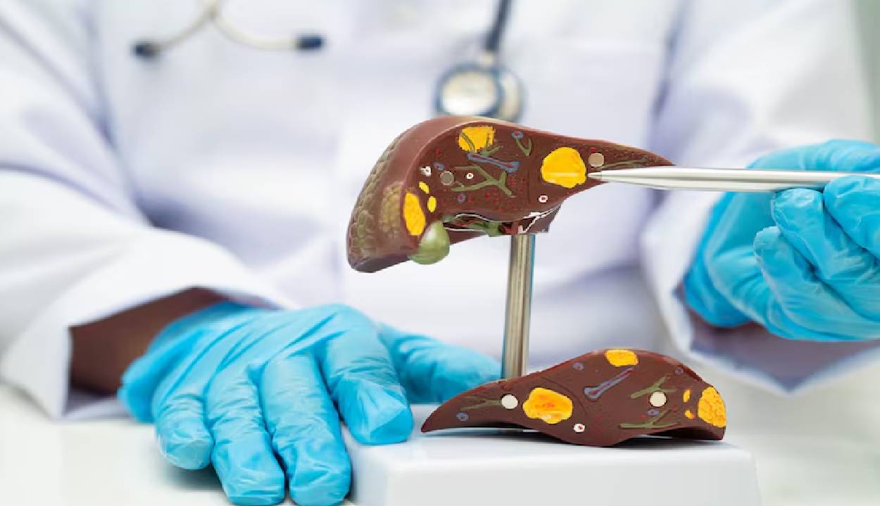 World Liver Day 2026: बच्चों में बढ़ रहा फैटी लिवर का खतरा, विशेषज्ञों ने दी चेतावनी