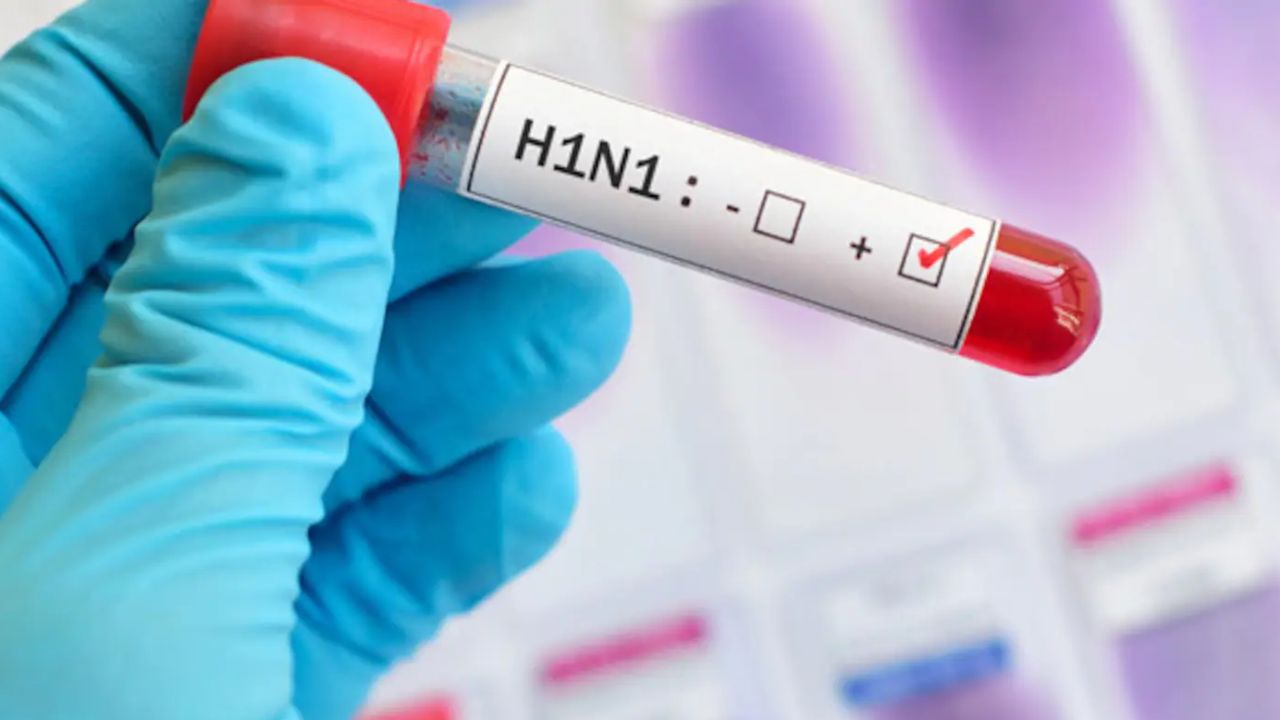 कर्नाटक में स्वाइन फ्लू का आंतक, H1N1 के 4 हजार से ज्यादा मामले दर्ज; सरकार ने जारी की एडवाइजरी
