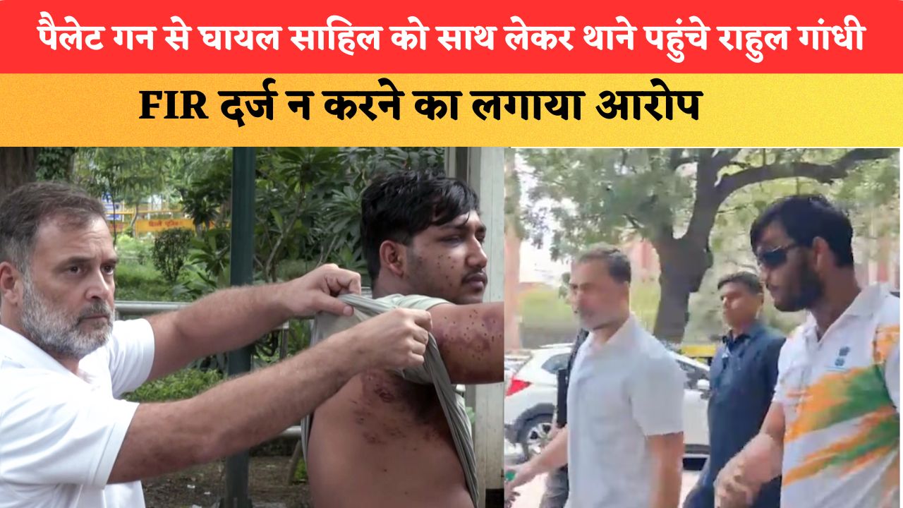 पैलेट गन से घायल साहिल को साथ लेकर थाने पहुंचे राहुल गांधी, FIR दर्ज न करने का लगाया आरोप