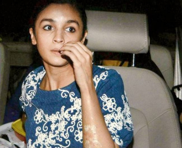 पटाखें की वजह से आफत में पड़ी आलिया की जान