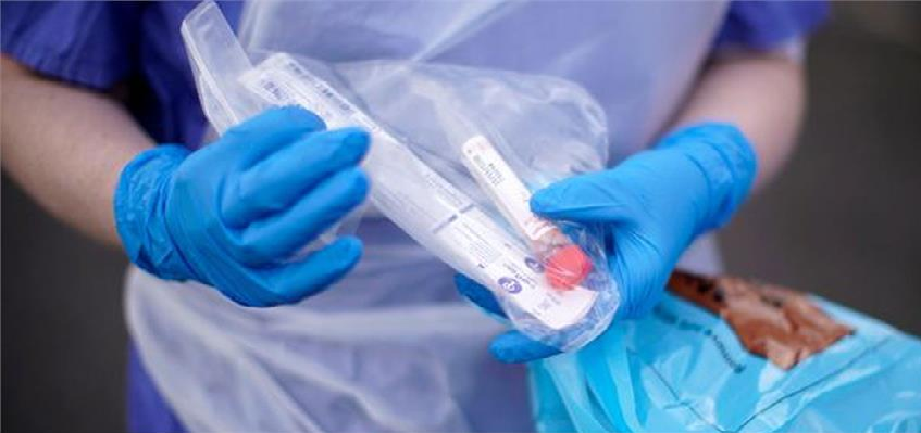 Corona Infection Test Update:  रैपिड टेस्ट किट की क्वालिटी पर सवाल, ICMR ने लगाई इस्तेमाल पर इतने दिनों की रोक, आखिर क्यों जानें?