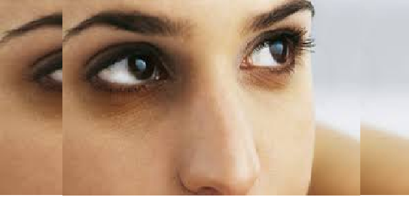 Remove Dark Circle :  ऐसे हटाएं आंखों के नीचे के काले धब्बे,  करें इस नुस्खे का इस्तेमाल