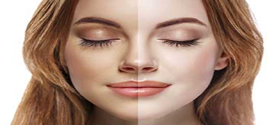 How to get fair skin:  10 दिनों में  पाएं सांवली त्वचा से गोरे होने का राज, अपनाएं ये घरेलू टिप्स