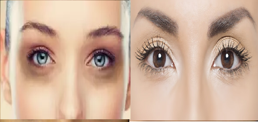 Tips For Removal Of Dark Circles:  डार्क सर्कल से कैसे पाएं छुटाकारा, जानें कुछ ऐसे घरेलू उपाय
