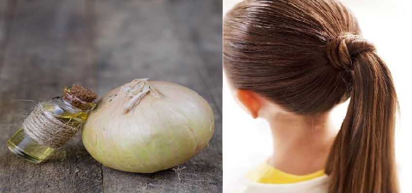 Onion juice for hair growth: बालों के लिए प्याज का रस कितना फायदेमंद, जानें कुछ उपाए