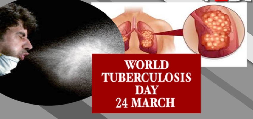 World Tuberculosis Day:  पूरी दुनिया में एक दिन होती है 4000 मौतें, क्या हैं इसके शुरुआती लक्षण