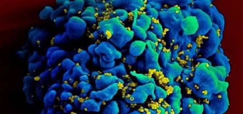 Health tips: कोरोना के बाद तबाही मचाने को तैयार नोरोवायरस! जानें लक्षण और बचाव