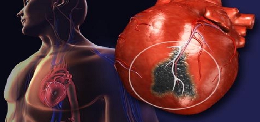 HEALTH TIPS: दिल सुरक्षित तो आप सुरक्षित, जानें कैसे HEART ATTACK जैसी बीमारी को कैसे रखें खुद से दूर