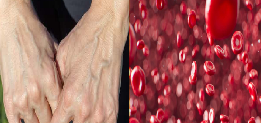 लाल रंग का खून नसों में क्यों दिखाई देता है नीला और जामुनी, जानें वजह