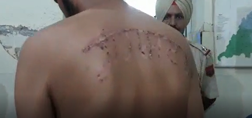 PUNJAB: फिरोजपुर जेल में कैदी के साथ हुई हैवानियत, फोटो देख उड़ जाएंगे आपके होश