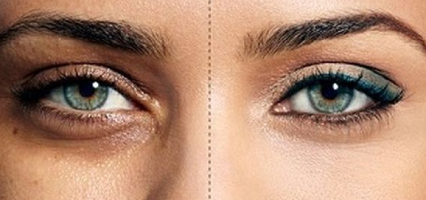 Health tip: क्या आप भी है डार्क सर्कल्स से परेशान? इन 5 तरीकों से कर सकते है उनको चुटकियों में गायब!