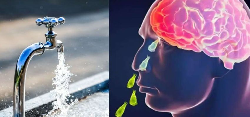 नल के पानी से नाक धोने पर व्यक्ति की मौत, इस स्टोरी को पढ़ने के बाद आपको भी लगेगा चेहरा धोने से डर