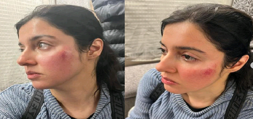 Yaariyan 2: शूटिंग के दौरान गंभीर रूप से घायल हुई Divya Khosla, फोटो साझा कर कही ये बात