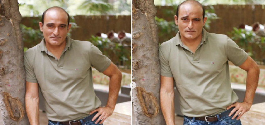 गंजापन इस एक्टर के लिए बना गले की फांस, हमेशा के लिए लग गया फिल्मी दुनिया पर ब्रेक