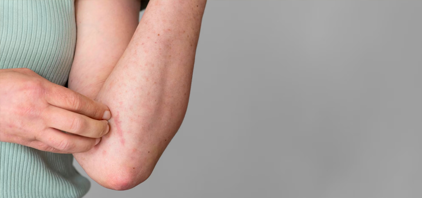 Monsoon Health Tips: बारिश के मौसम में बढ़ जाता है स्कीन इंफेक्शन का खतरा, इन बातों का रखें ख्याल