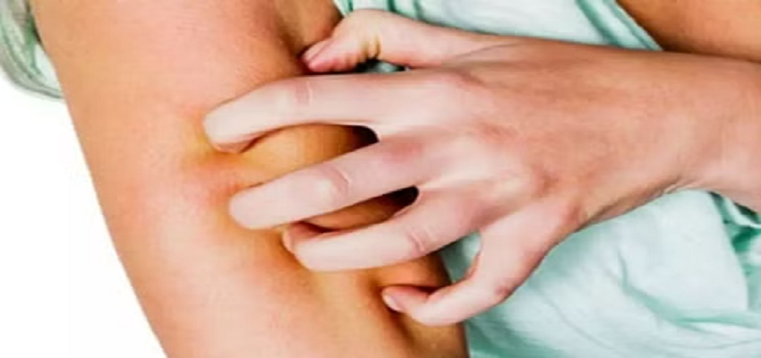 HEALTH TIPS: मानसून के दौरान इस बीमारी का बढ़ जाता है खतरा, जानें कैसे कर सकते हैं बचाव