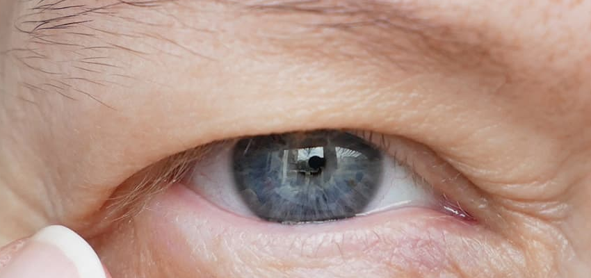 Health Tips: क्या है पीटोसिस? जिससे कारण आपकी आंखें हो सकती हैं खराब