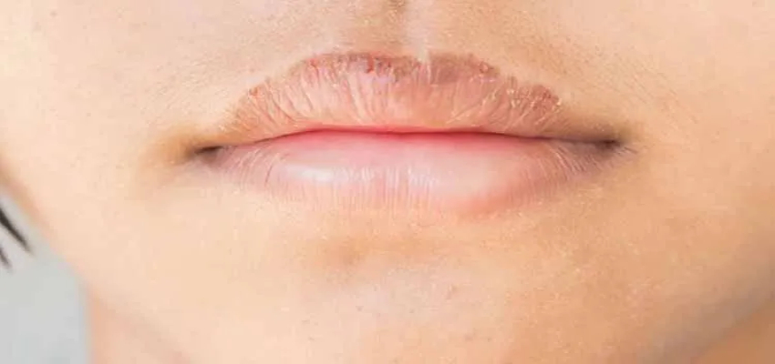 Lip Color Health: लाल, गुलाबी, सफेद, काले...होंठों के बदलते रंग से मिलता है इन बीमारीयों के संकेत