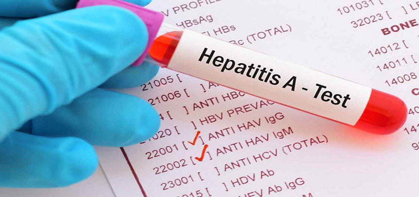 Hepatitis In Kerala: केरल में ‘हेपेटाइटिस-ए’ से 12 मरीजों की मौत, आखिर क्यों जानलेवा हो गई ये बीमारी?