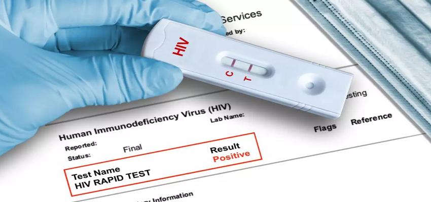 देश के इस राज्य में तेजी से फैल रहा है HIV, 828 छात्र हुए पॉजिटिव, 47 की मौत