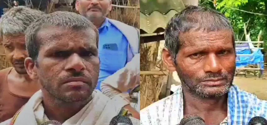 ये UP है भईया यहां कुछ भी हो सकता है! पेंशन का लालच देकर कुंवारों की भी कर दी नसबंदी