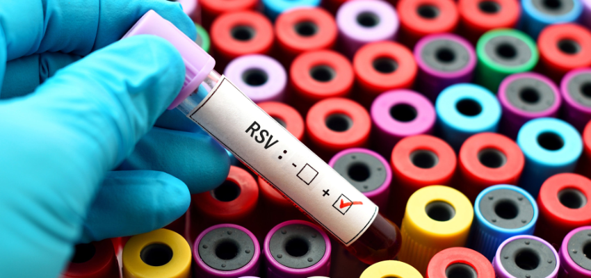 HMPV से निपटने की तैयारी शुरू, बाहर से आने वालों का होगा आरटीपीसीआर टेस्ट