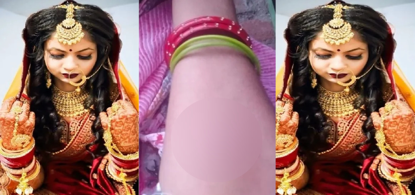 गर्म चिमटे से पिटाई, कोल्ड ड्रिंक में दिया जहर...नोएडा के Nikki हत्याकांड जैसी नई कहानी, फिर एक बहू चढ़ी दहेज की बलि