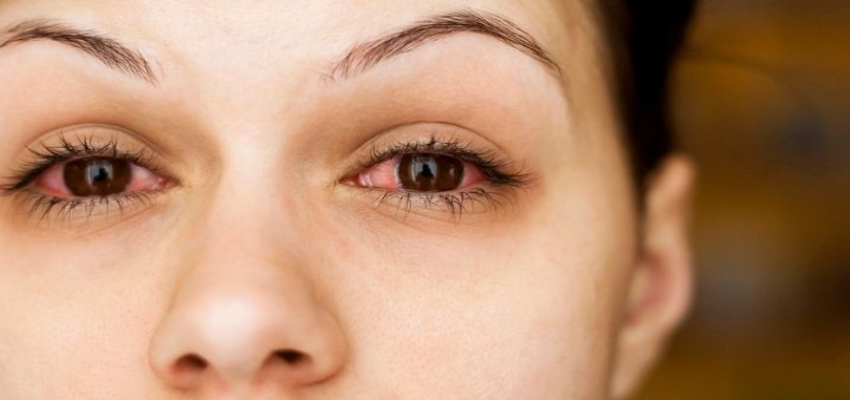 दिल्ली-NCR की जहरीली हवा से फेफड़े ही नहीं, आंखें भी बेहाल; AIIMS के डॉक्टरों से जानें बिना दवा आंखों की सुरक्षा के तरीके