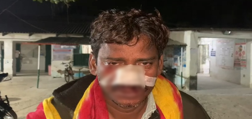 
							छोटे भाई को गाली दे रहे चचेरे भाई को समझाने गए व्यक्ति की तलवार से काटी नाक, घटना के बाद आरोपी फरार