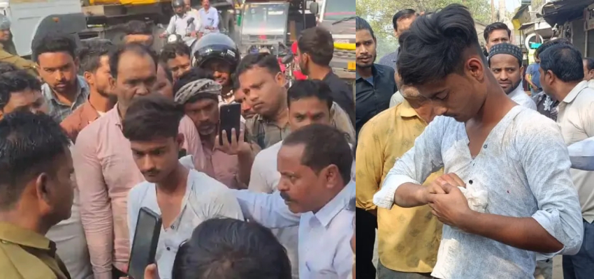 
							हाय रे कालयुग! 7 रुपए के लिए युवक बना हैवान; काट डाली दुकानदार की उंगली