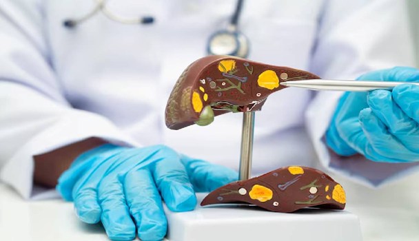 World Liver Day 2026: बच्चों में बढ़ रहा फैटी लिवर का खतरा, विशेषज्ञों ने दी चेतावनी